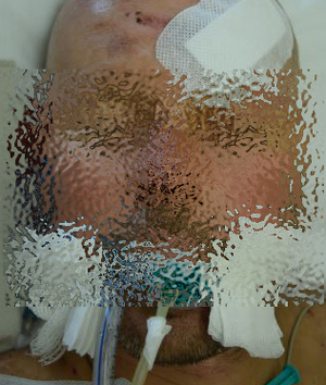 Potrącony przez tramwaj mężczyzna